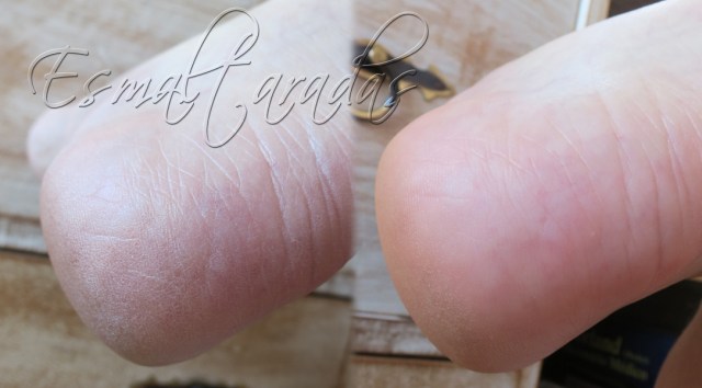 Dry heel eliminator2